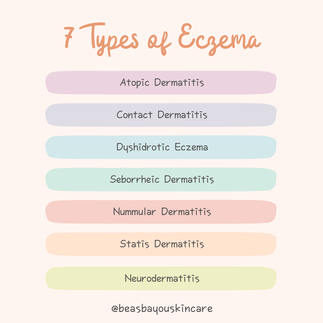 7 Types of Eczema - Bea's Bayou Skincare