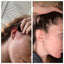 A side-by-side comparison showing the same woman before and after using Bea's Bayou Prebiotic Facial Essence & Toning & Setting Glow Mists Bundle. The left image highlights her irritated, red skin around the ear and jawline. The right image shows clearer, less irritated skin. She is holding her hair up in both images, revealing the remarkable transformation.